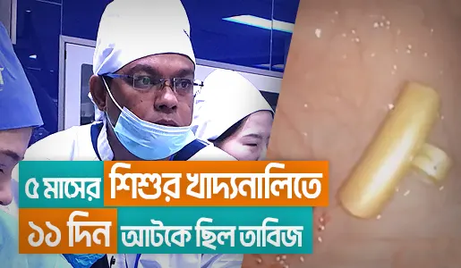 Amulet Removal from a Child's Esophagus