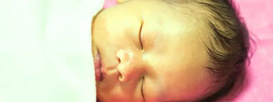 Symptoms of neonatal jaundice and how to check at home